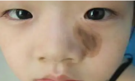 ̥�ǵ��ۺ��շ�������ʲô,�������й���