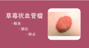 ��ݮ״Ѫ��������������������Լ���ʧ��