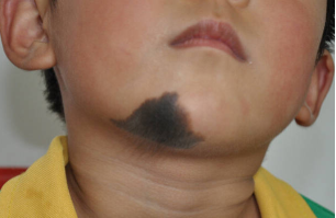 ��ë�������������ЩΣ��,�����ļ�ҽԺ��̥�Ǻã�