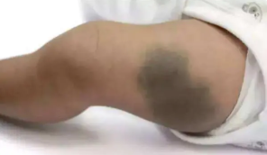 ����������Щ̥����Ҫ������Щ�������ӣ�