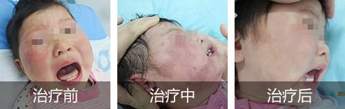 һ��Ҫ��ȷ�Դ��ʺ�̥�ǣ�����ᵢ������