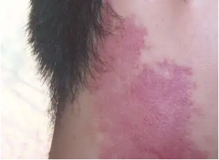 �沿�ʺ��������������𽥱����