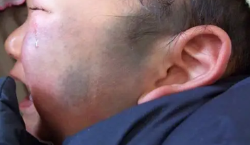 Ϊʲô�������ϵ�̫������Ҫ�������ƣ�