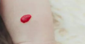 Ѫ����̥����ʲô,��Ҫ����������