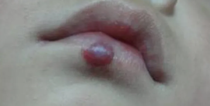 ëѪ���������Ʒ����Ƕ���?