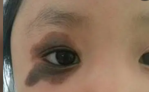 ��̥�ǵ�֢״��ʲô���Խ�����ʲôΣ����