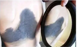 ̫���벻����ͨ��̥��,�������һ����Σ��