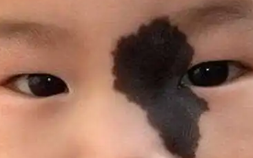 ������̥����ʲô���͵�,������ר������̥�ǵ�ҽԺ��?