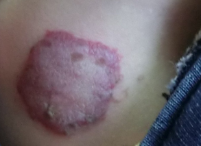 �����Ѫ����