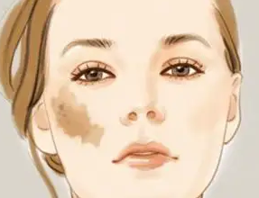 ���Ȱߵĳ����Լ�֢״_����̥��ҽԺ