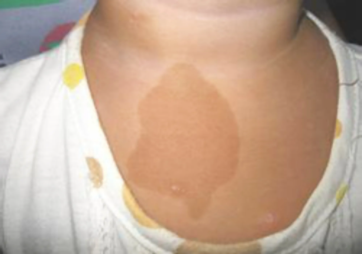 Ӥ��������̥�ǶԽ�����Ӱ����