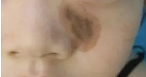 ����̥��ʱ�����߳�����������ʲô��