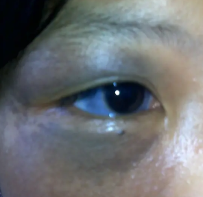 ̫�����֢״��ʲô���������������ĸ���λ��