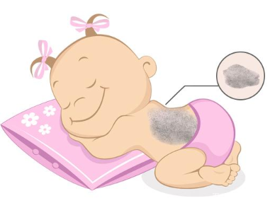 所以蒙古斑的成因是什么?