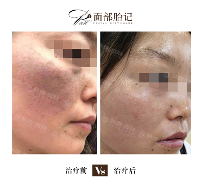 ҽ��������Ϊʲô��Ỽ�п��Ȱ�,���Ĳ�����ʲô��