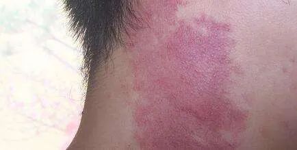 �����ļ�ҽԺ�����������̥���أ�