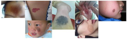 ̥�ǵĶ��ֲ�ͬ���Ʒ���