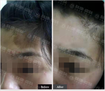 �红�ӻ���̫�������δ���_����Ƥ����