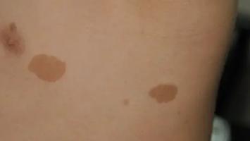 ҽ����ʾ��������Դ����Ȱ�,����ʱ���д���