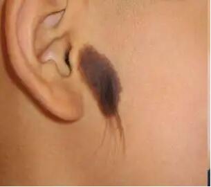 ���ϳ��˺�ë���ܱ�������,��ʲô������