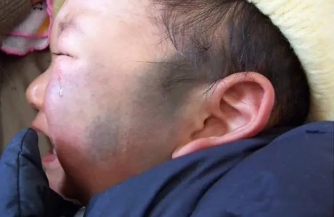 ̫����Ả�ӵ�Ӱ��