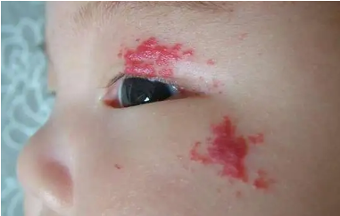 �ĸ��µ�Ӥ��������̥�Ǹ���δ���