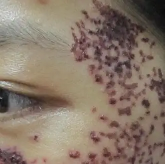 ����Ƥ��,̫���뾭������֮����Ҫע����Щϸ��?