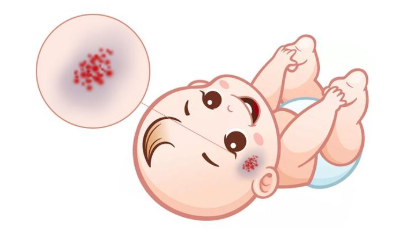 Ӥ������Ѫ����