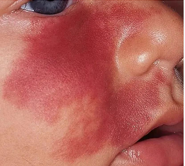 Ӥ���ʺ�̥��