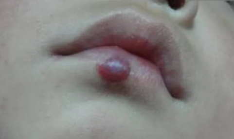 �����Լ�����Ѫ����,�������Ե���,�ᰩ����