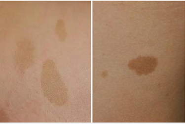 Ҫ����жϺ��ӵĿ��Ȱ��Ƿ��������ά��?