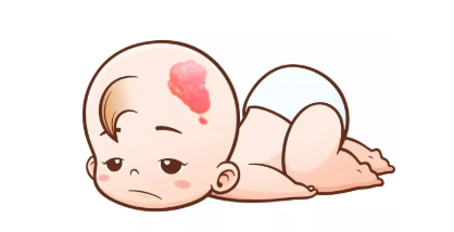 血管瘤是良性的吗,会不会变成癌?