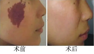 ����̥�����Ƽ��βŻ���Ч��������̥������ҽԺ