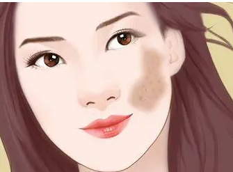 �Ѿ��κõĿ��Ȱ��ָ�����ô�죿�����ļ�ҽԺȥ̥��