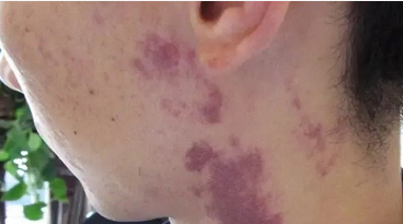 �ʺ���������������ȫ���������̥��ҽԺ����