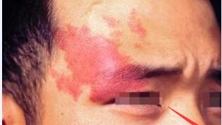 �����ѶȱȽϴ���ʺ��������Ӧ�ԣ�����̥�Ǽ�������