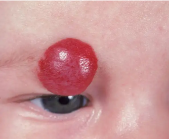 С����Ѫ�������Ѹ���λ�������������̥��