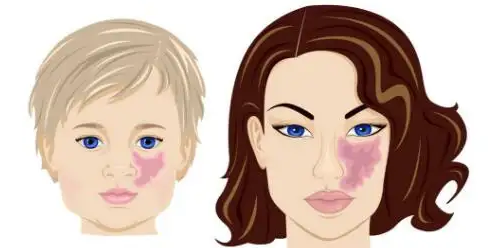 �ʺ�����֢״��ʲô,��Ҫ������