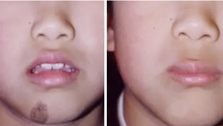 С���°���̥�ǻ�Ӱ�콡����