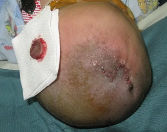 ����������Ѫ������������ϴ����