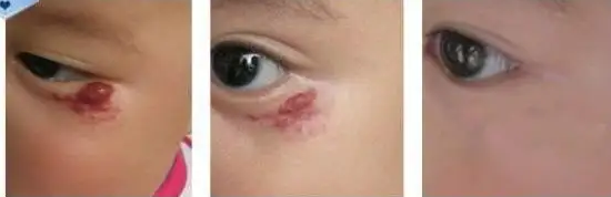 ��Щ��������̥�Ǻ�