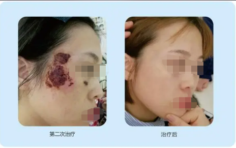 ��̥���Ȱ������ȷӦ��̫���룿