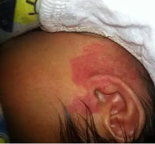 С�����ϳ�̥����ô�죿